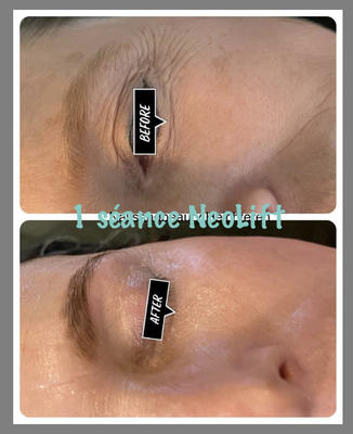 Slym &amp; Tan by megaSun