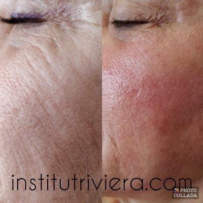 Institut Riviera Antibes