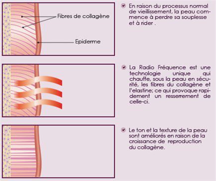 Institut Grain de Beauté