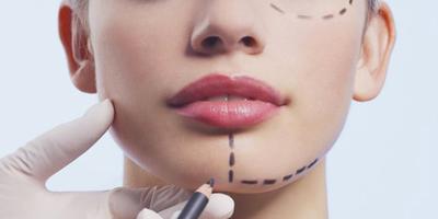 Dr Nassim Sidhoum, Chirurgien esthétique à Rennes