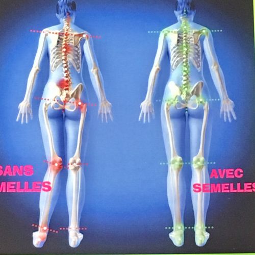 Podologue Orthopédie