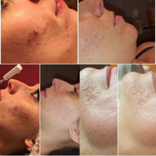 Slym &amp; Tan by megaSun