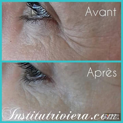 Institut Riviera Antibes